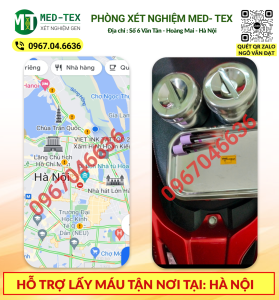 xet nghiem mau 24h