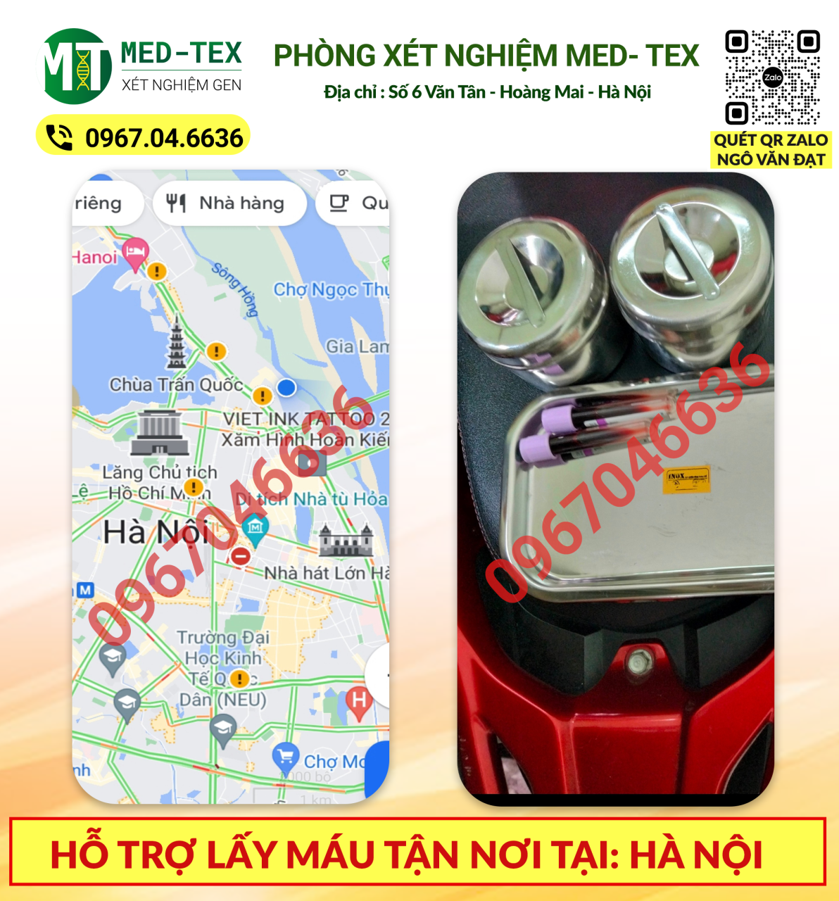 xet nghiem mau 24h
