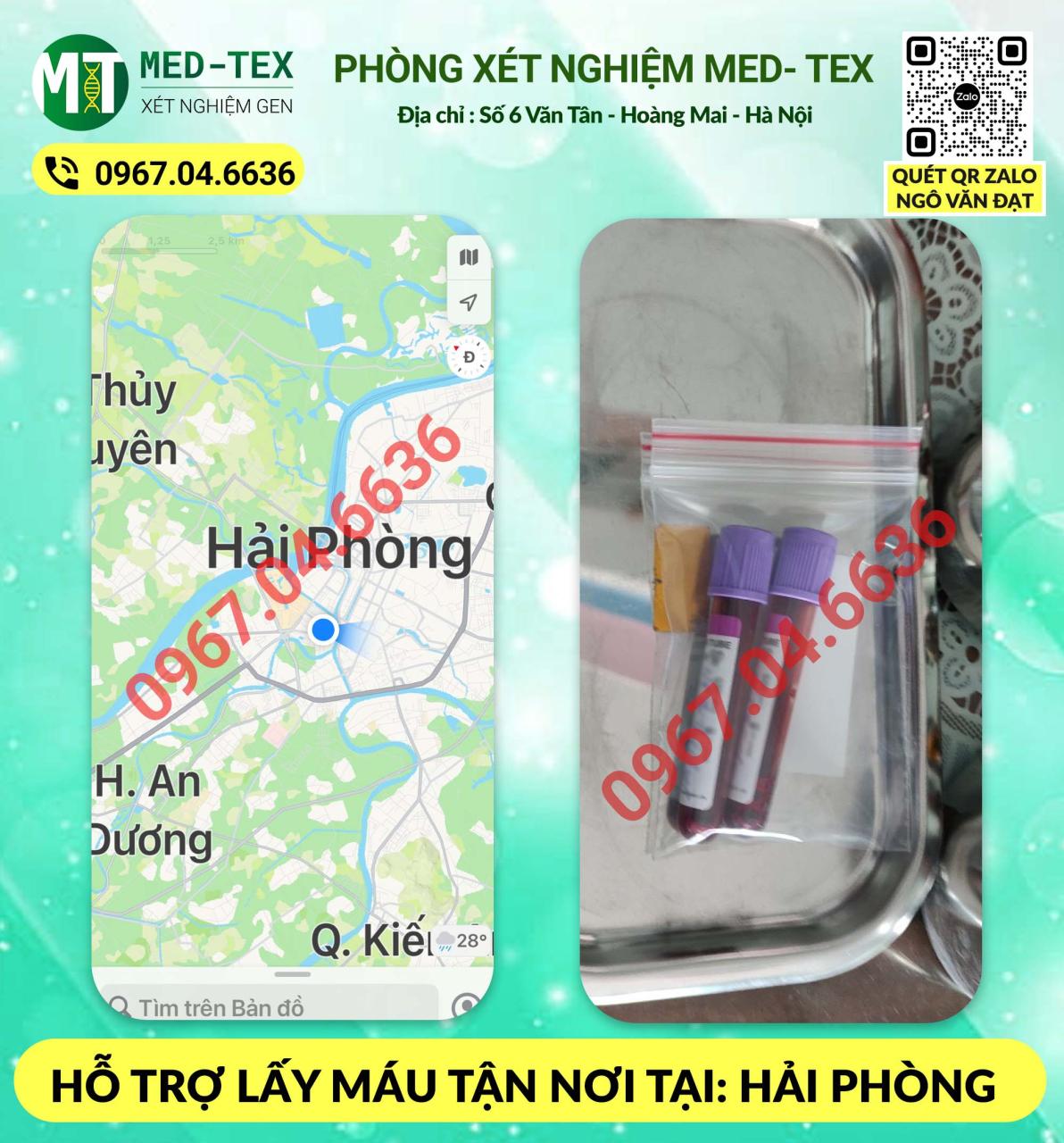 xet nghiem mau 24h