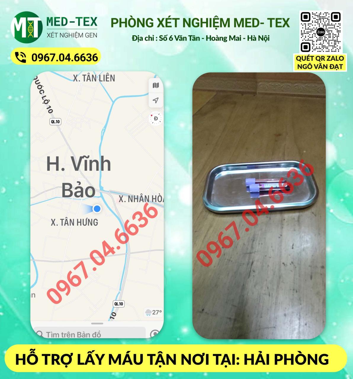 xet nghiem mau 24h
