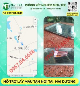 xet nghiem mau 24h