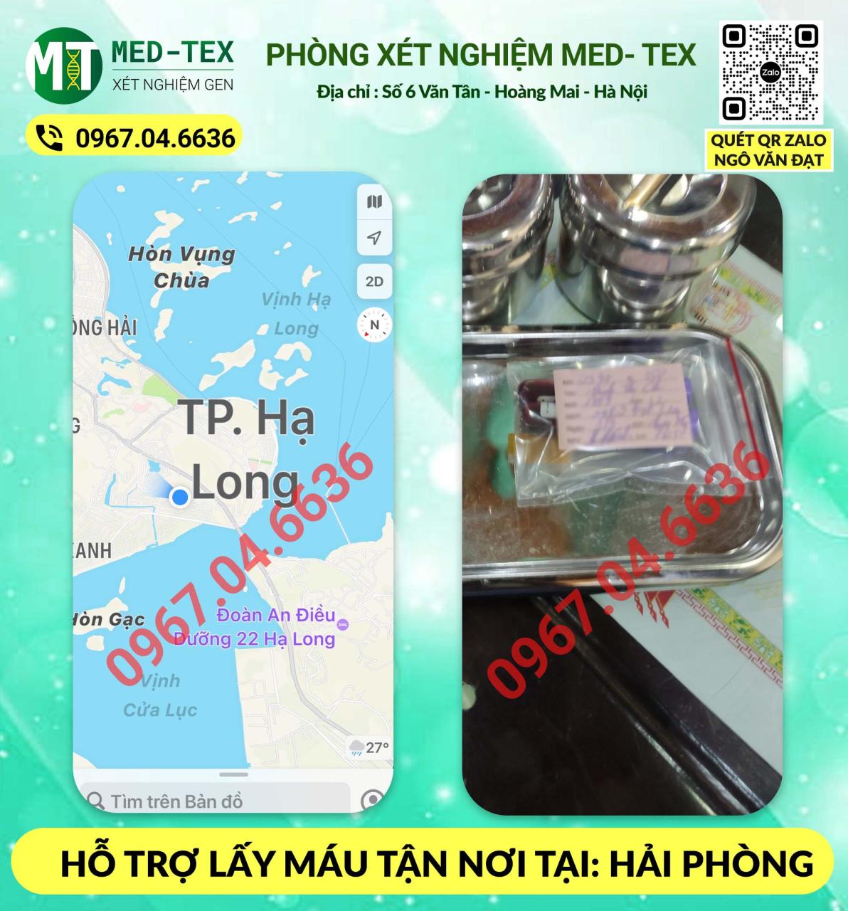 xet nghiem mau 24h
