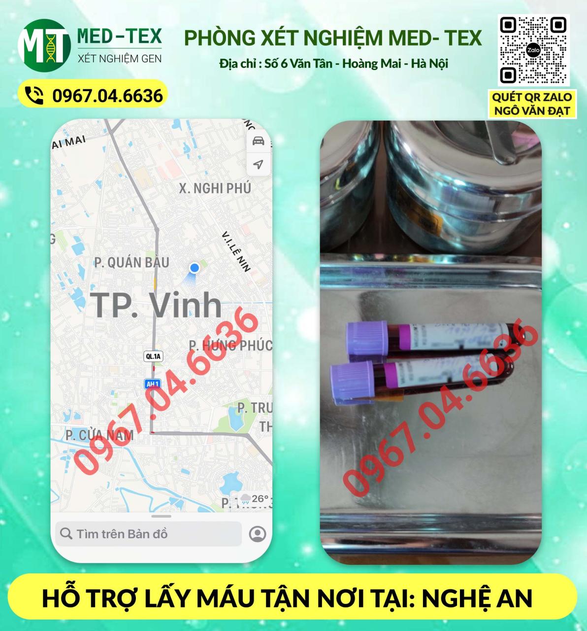 xet nghiem mau 24h