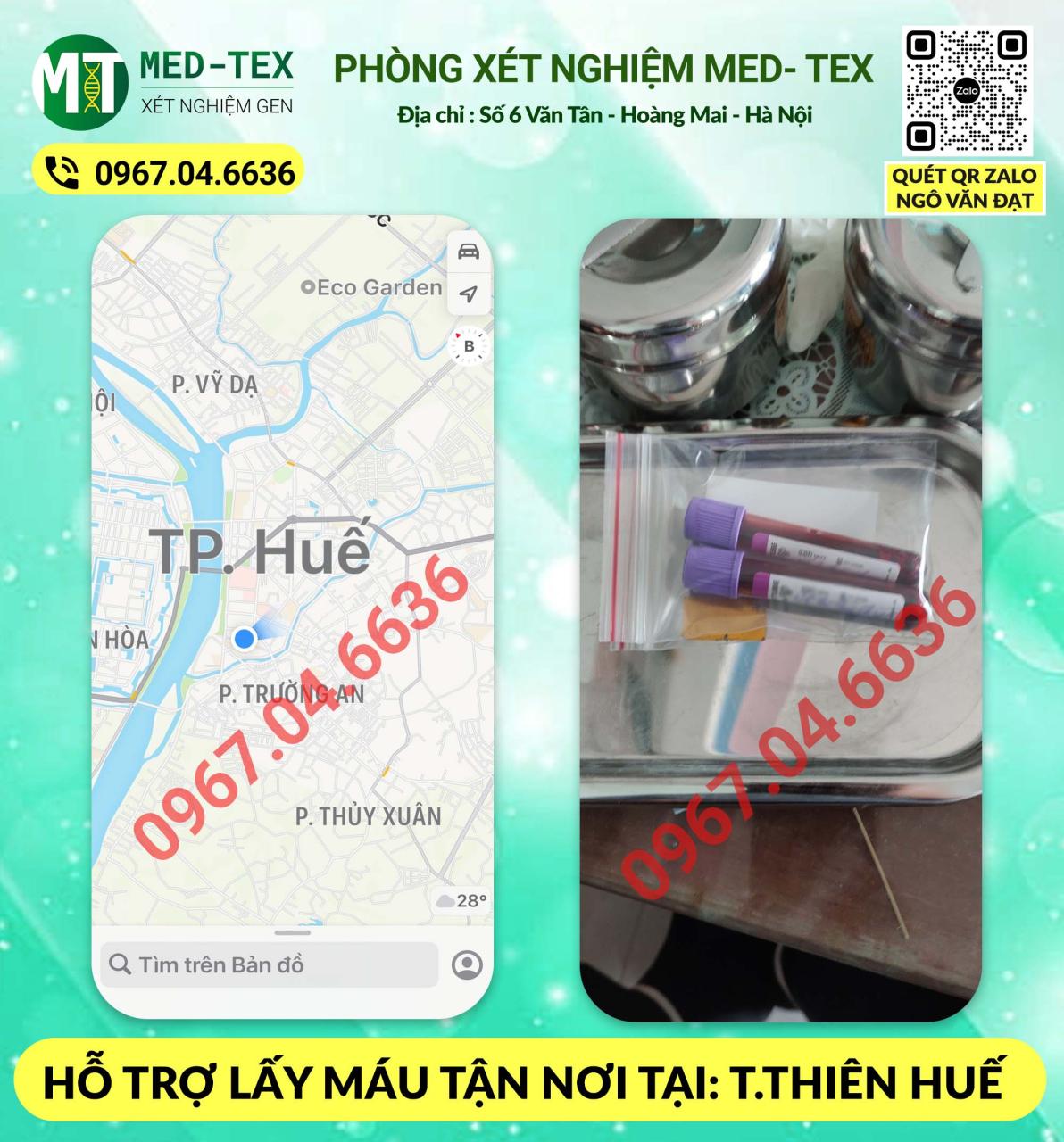 xet nghiem mau 24h