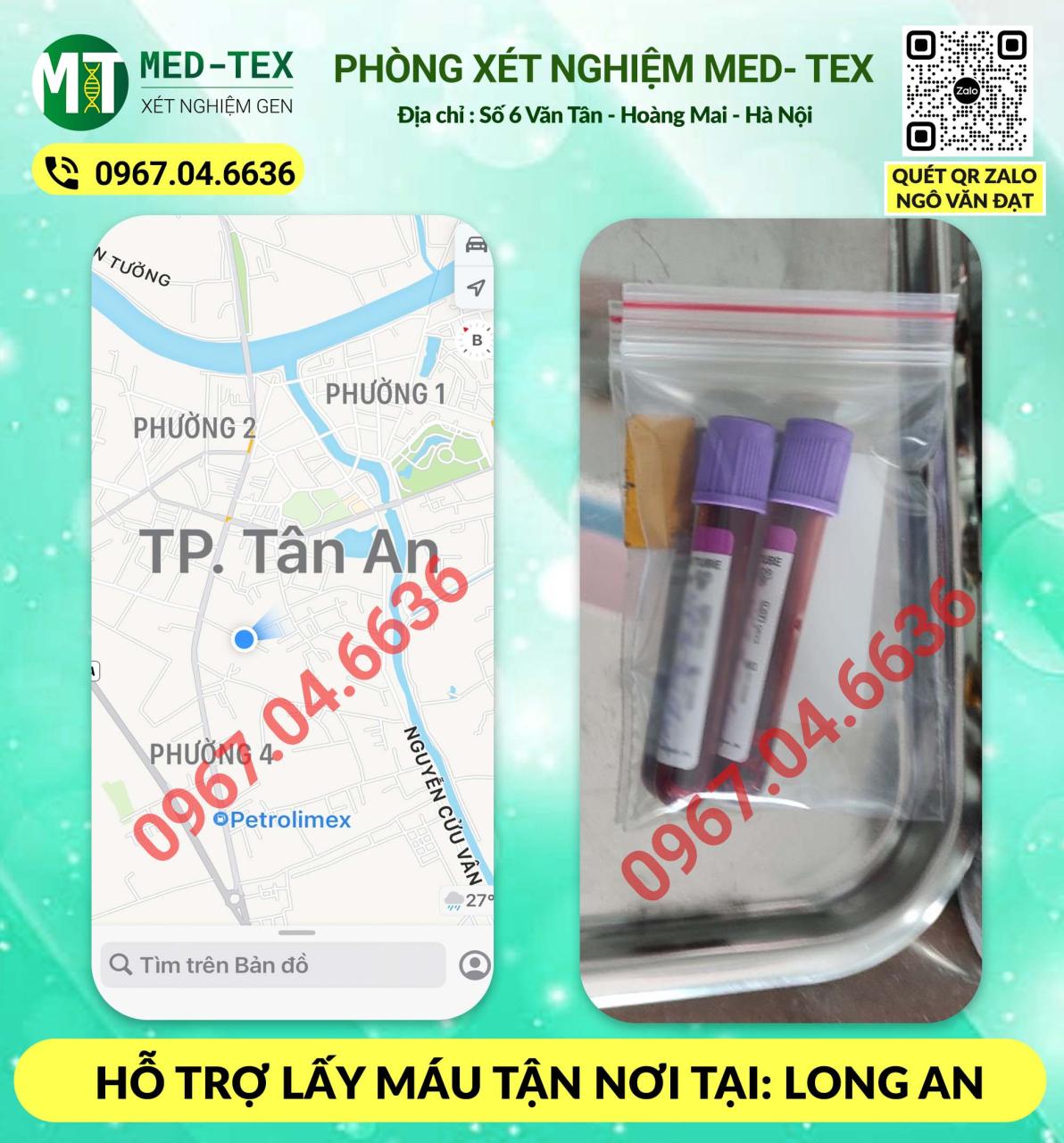 xet nghiem mau 24h