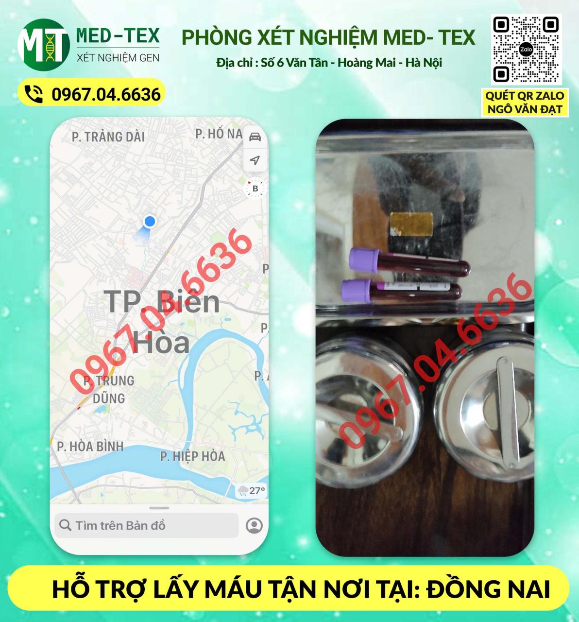 xet nghiem mau 24h