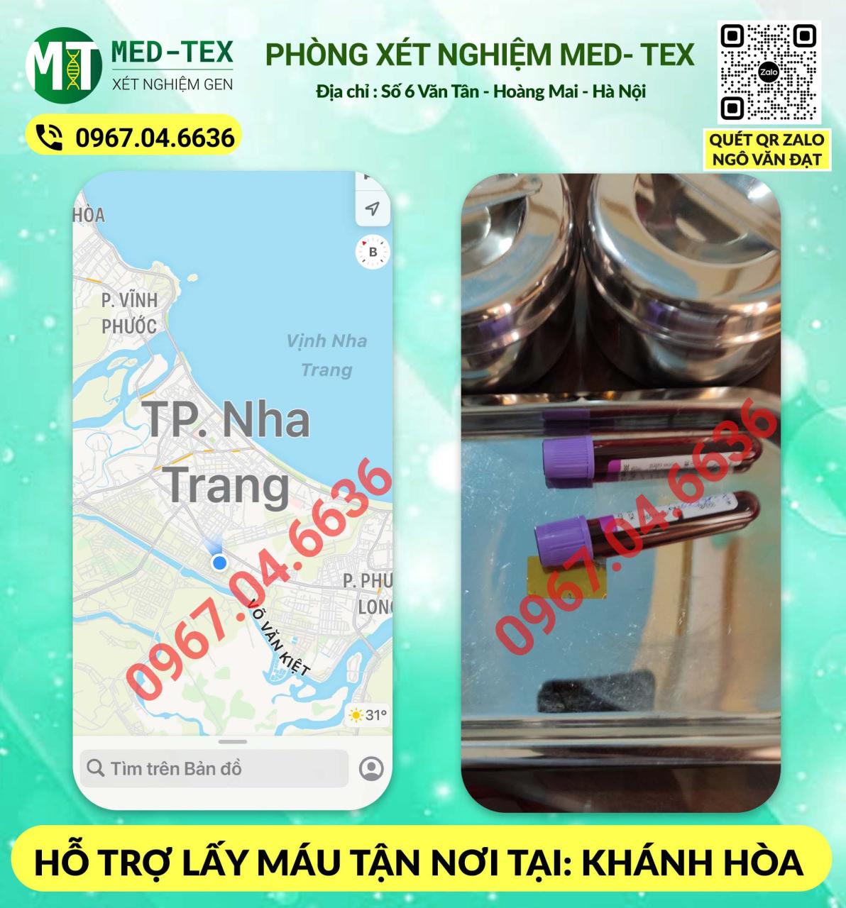 xet nghiem mau 24h