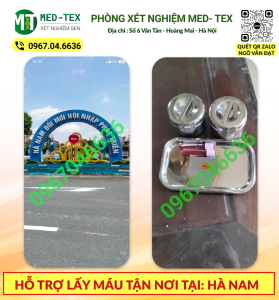 xet nghiem mau 24h