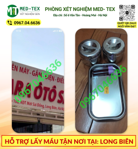 xet nghiem mau 24h