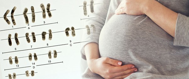 Xét nghiệm Giới Tính XY